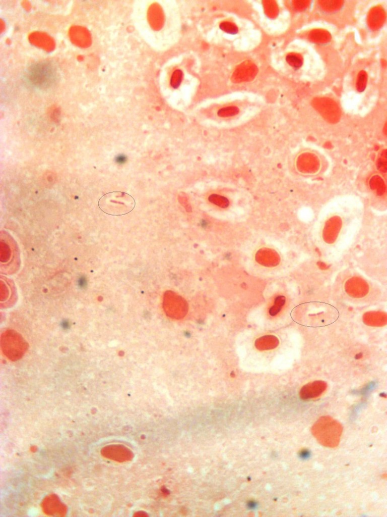 Yersina ruckeri у размазу слезине калифорнијске пастрмке