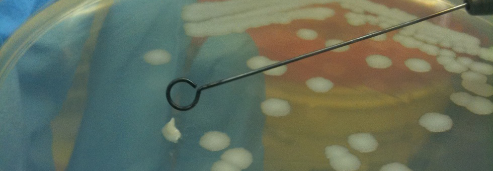 Шести слајдер