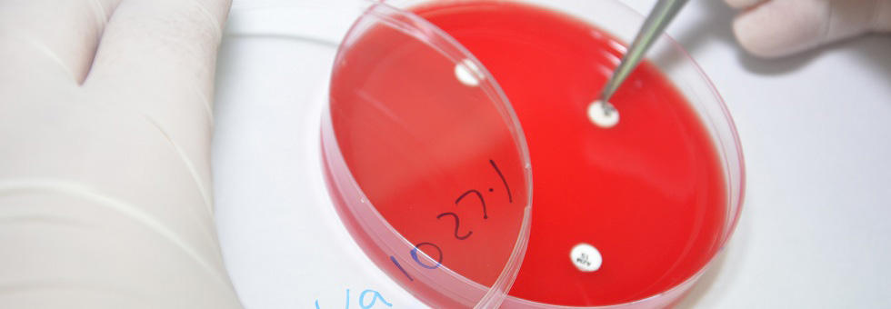 Четврти слајдер