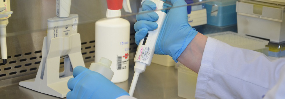 Пети слајдер